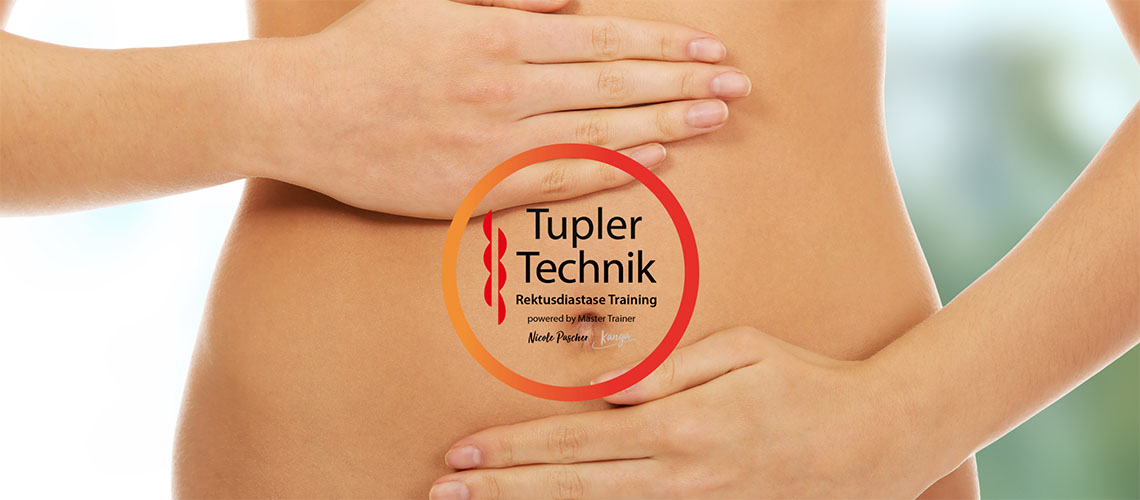 Rektusdiastase